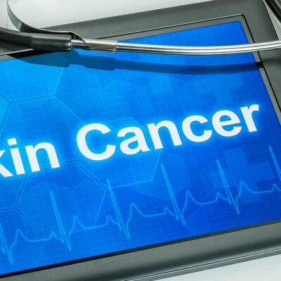 Skin cancer – Types and warning signs