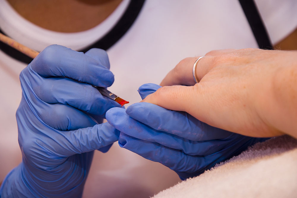 Nail fungal infection – Causes, symptoms, and management